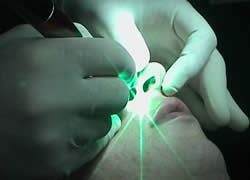 laser medicina
