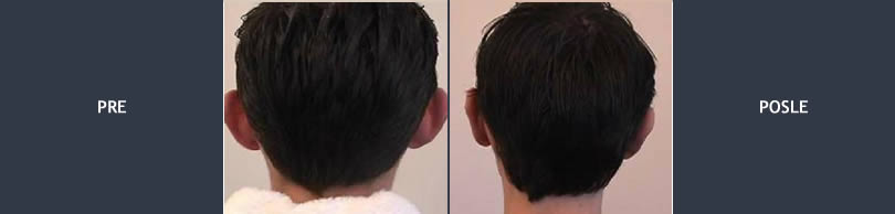 operacija usiju slika