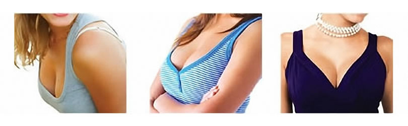 breast surgery