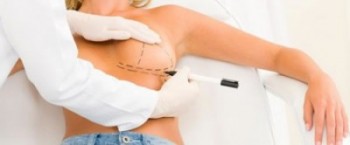 zatezanje i podizanje grudi slika 1