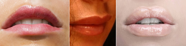 lipenvergrosserung-und-modellierung-von-lippen