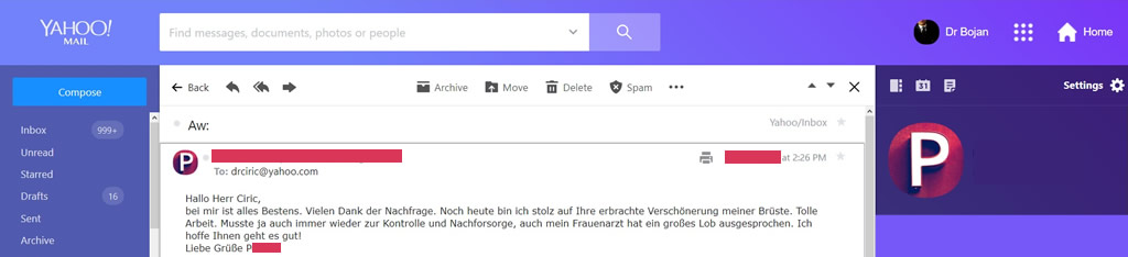 povecanje grudi pre posle mail zahvalnosti